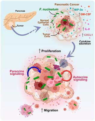 Insights and therapeutic advances in pancreatic cancer: the role of electron microscopy in decoding the tumor microenvironment